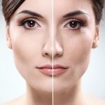 Anti aging treatment by Moshaz Beauty Salon