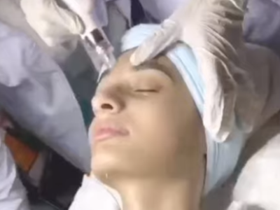 Hydrafacial-in-Rawalpindi-Islamabad